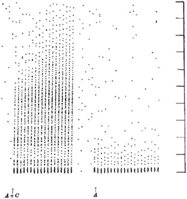 The Path to Discovery of Windup and Central Sensitization